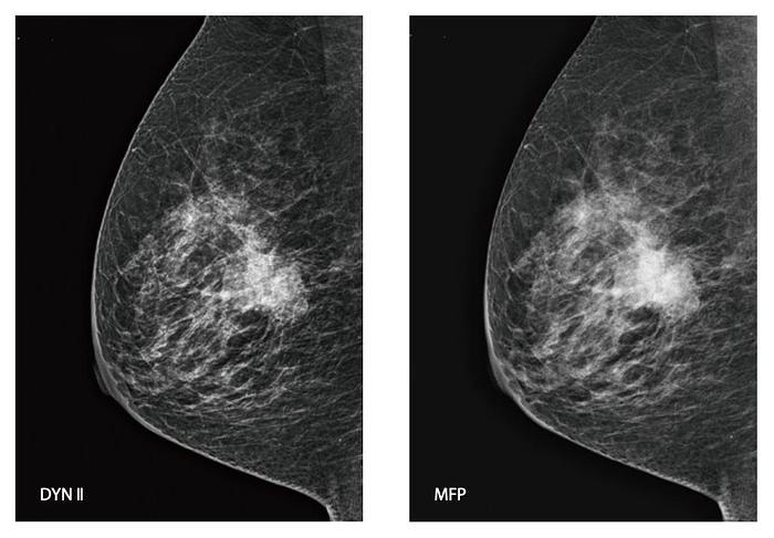 2022 FujiFilm FDR Amulet Innovality 3D