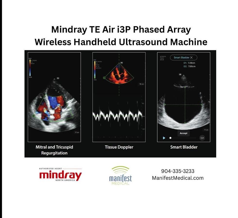 High Resolution | Mindray TE Air i3P Handheld Ultrasound Machine For Sale | Manifest Medical