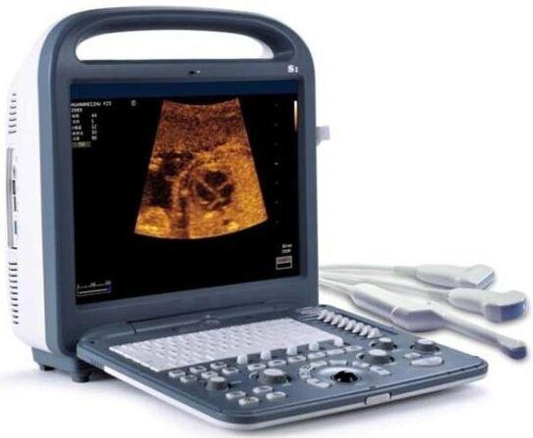 Used For Sale SONOSCAPE S2 Ultrasound Machine