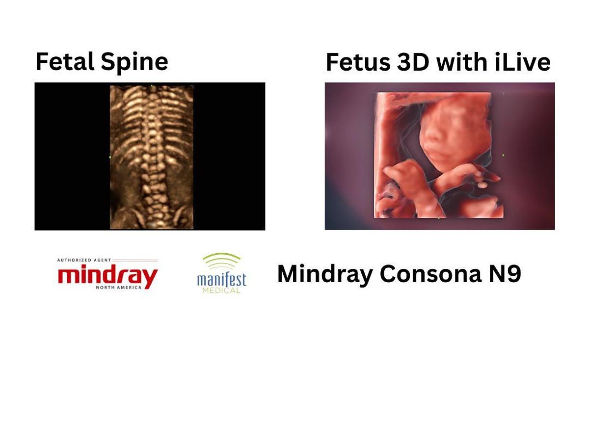 Fetal 3D Volume Scans | Mindray Consona N9 Ultrasound Machine For Sale