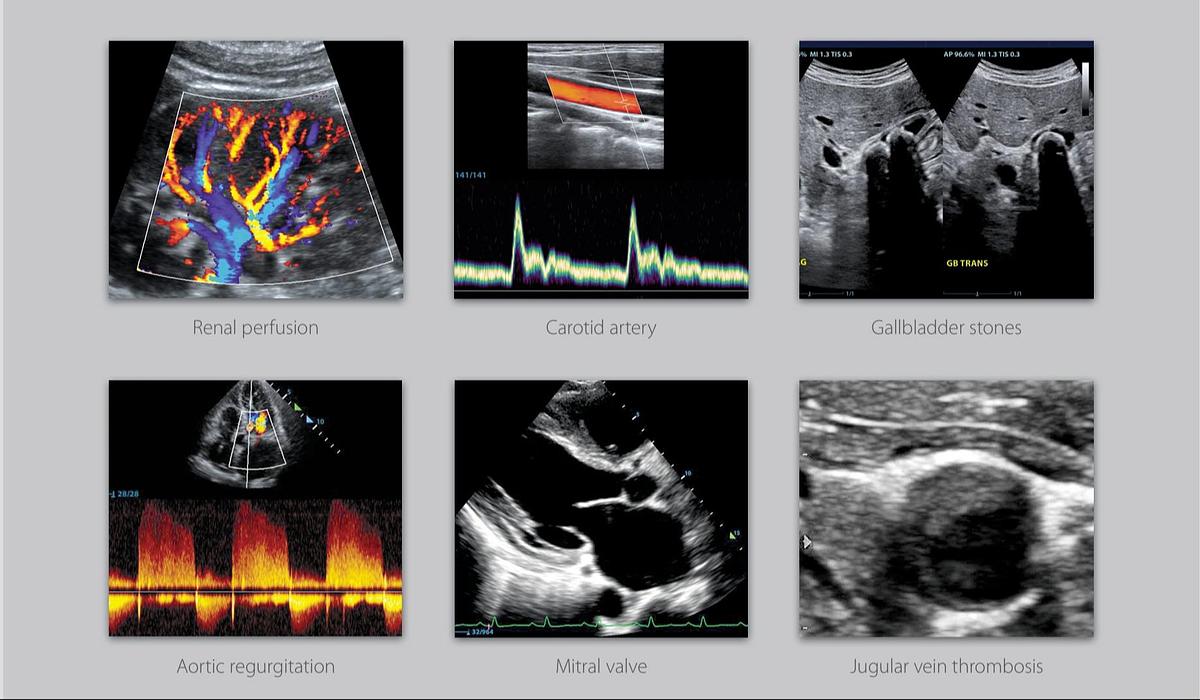 Mindray M8 Elite Ultrasound Machine For Sale | Point Of Care Ultrasound Scans | Manifest Medical