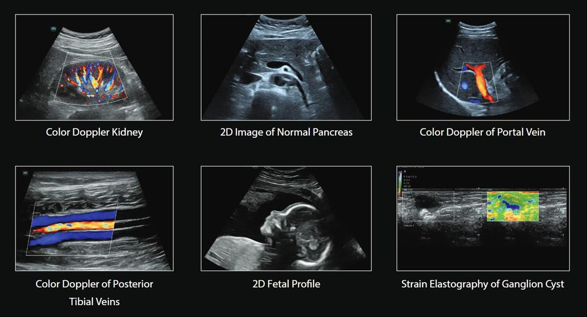 Color Doppler Scans Images | Consona N6 Ultrasound Machine For Sale | Manifest Medical