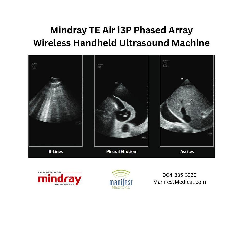 2025 MINDRAY TE AIr i3P Phased Array Wireless cardiac ultrasound system