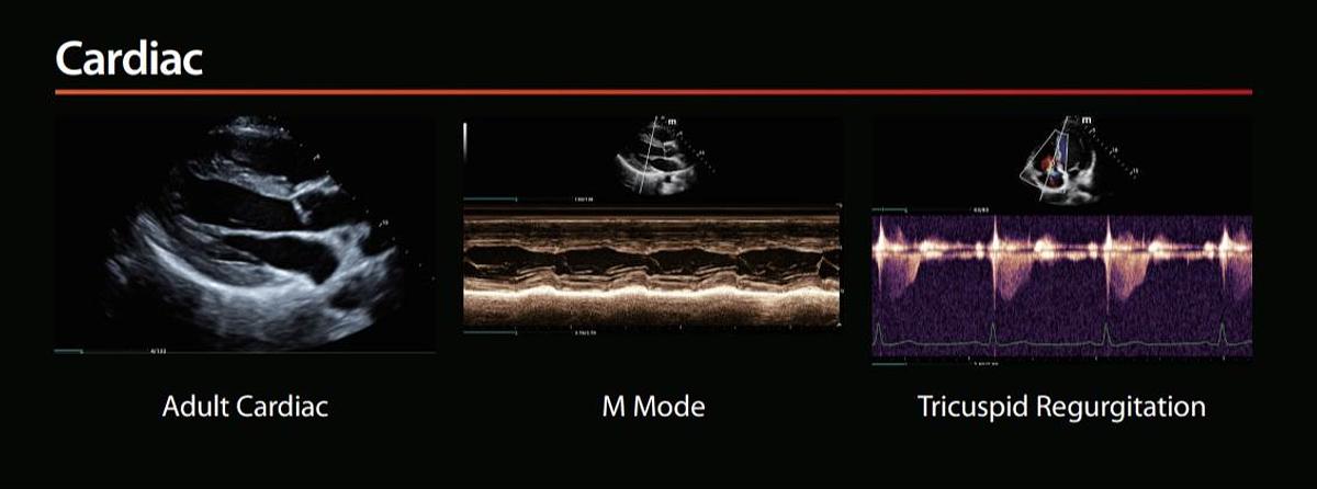 Mindray Mx7 Advanced CV Ultrasound Machine for Sale Cardiac Scans
