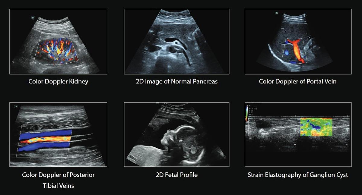 Mindray Consona N6 Ultrasound Machine for Sale or Rent | Manifest Medical