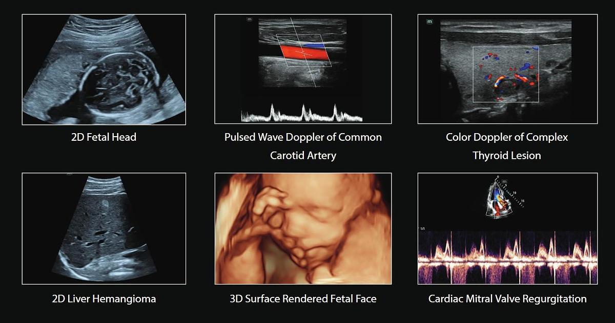 Mindray Consona N6 Ultrasound Machine for Sale or Rent | Manifest Medical