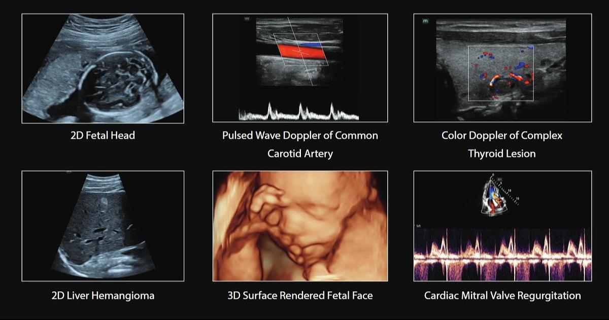 3D Fetal Scans | Mindray Consona N6 Ultrasound For Sale | Manifest Medical
