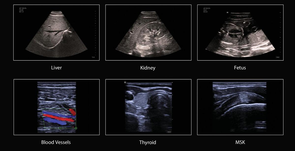 Mindray TE Air E5M Ultrasound Machine for Sale Liver, Kidney, Fetus, Blood Vessels, Thyroid, MSK scans for