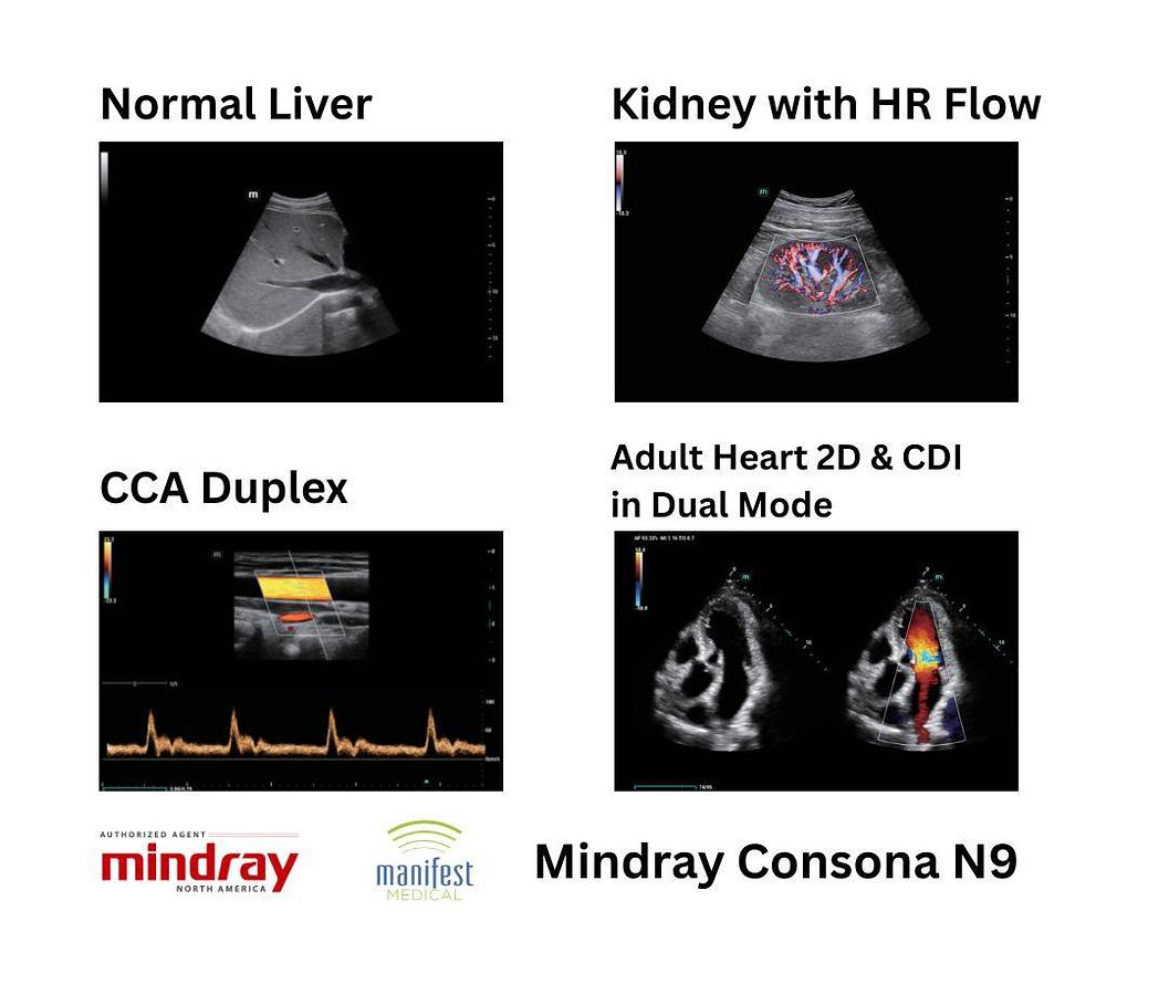 Mindray Consona N9 Ultrasound Machine Liver Kidney Heart CV Scans Manifest Medical