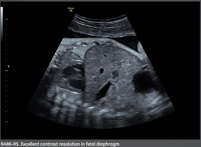 Used 2014 General Electric (GE) Voluson S8