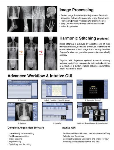 Rayence 1717SCV Tethered Flat Panel Detector (New)