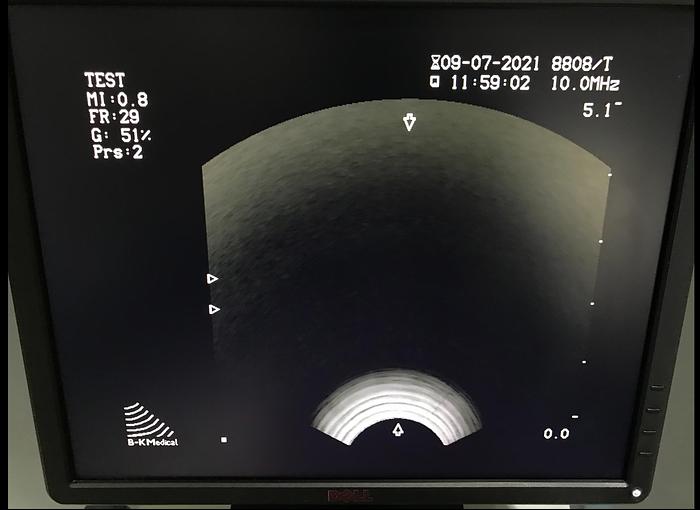 Gebraucht BK Medical 2101 Falcon Ultraschallgerät mit 3 Sonden und Sony Drucker