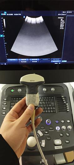 Gebraucht Alpinion SC1-6  Ultraschallsonde