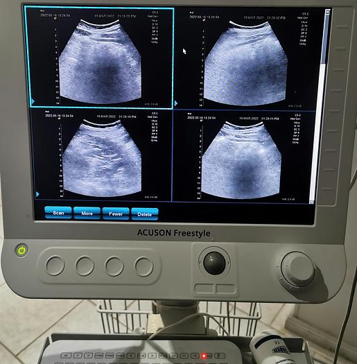 Gebraucht Siemens Acuson Freestyle Flachbildschirm portabel diagnostik Ultraschallgerät mit kabellosen Schallköpfen auf Trolley