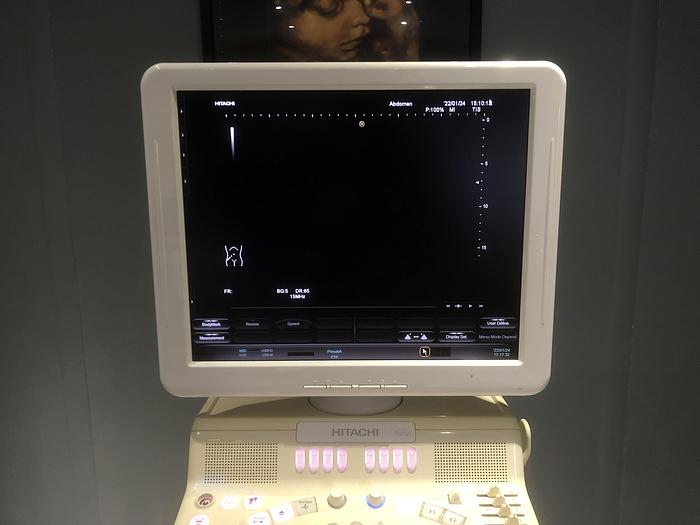 Gebraucht Hitachi-Avius-Ultraschallgerät-2007