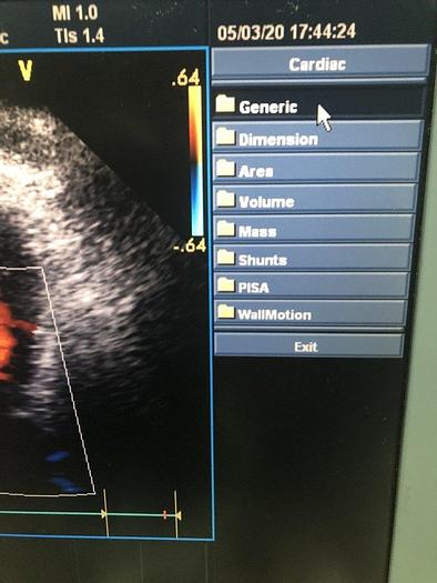 Gebraucht GE Vivid i Ultraschallsystem mit Kardio Sonde Software Version 2.1.16 auf GE Vivid i Trolley