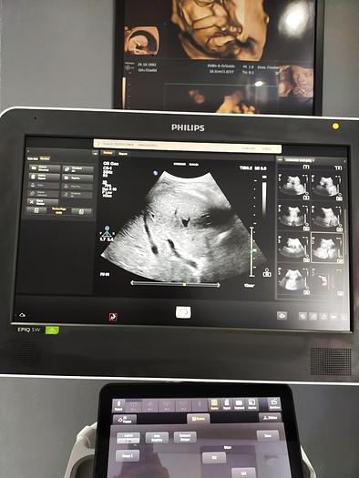 Gebraucht Philps EQIP 5W 1341