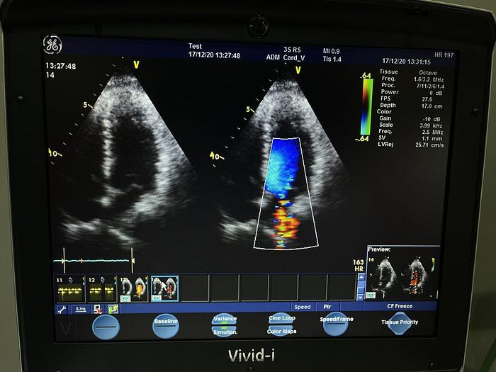Used GE Vivid i Ultraschallgerät mit 2x Sonden Software Version 2.1.16 auf GE Vivid i Trolley