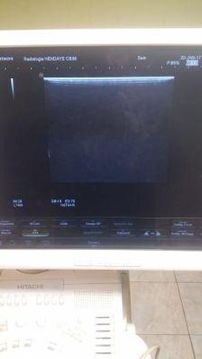 Used HITACHI HI VISION Preirus OB / GYN - Vascular Ultrasound