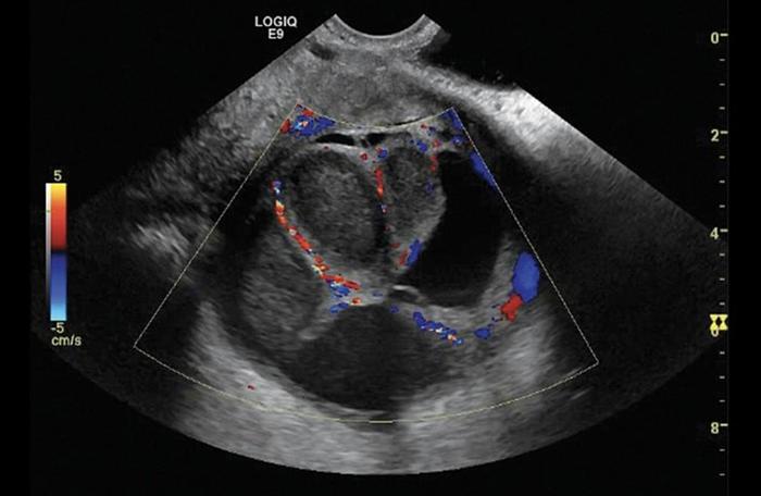 Used 2015 General Electric (GE) Logiq E9
