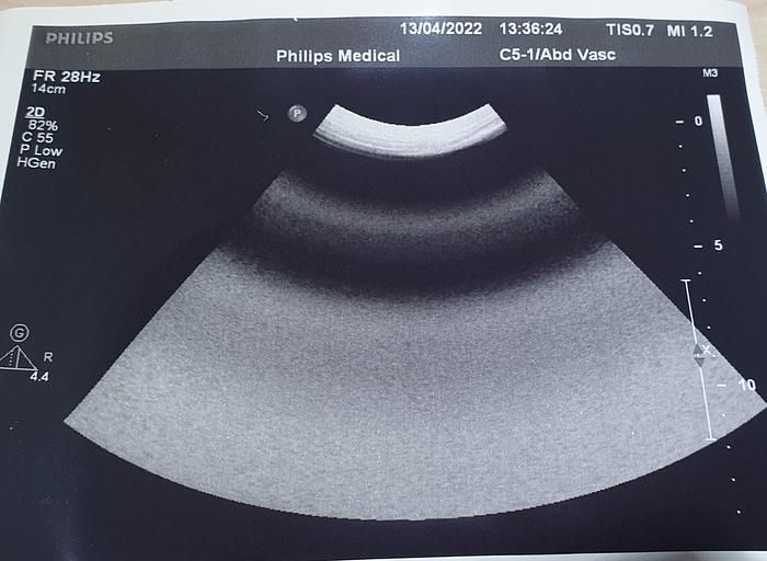 Gebraucht C5-1 philips ultrasound probe