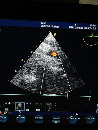 Gebraucht GE 6T Transösophageale Ultraschallsonde TEE Schlucksonde
