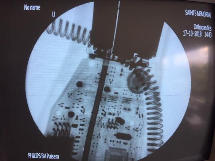 Refurbished 2002 PHILIPS PULSERA BV