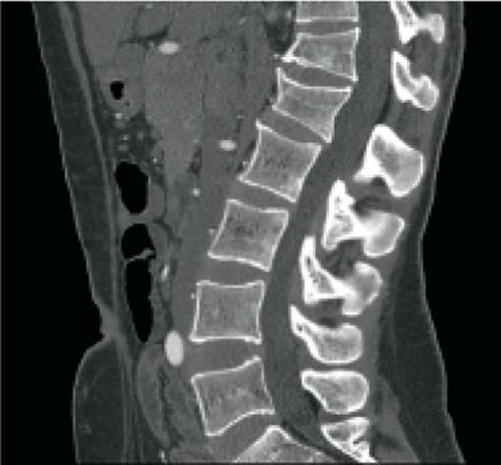 Refurbished 2010 General Electric (GE) LightSpeed VCT