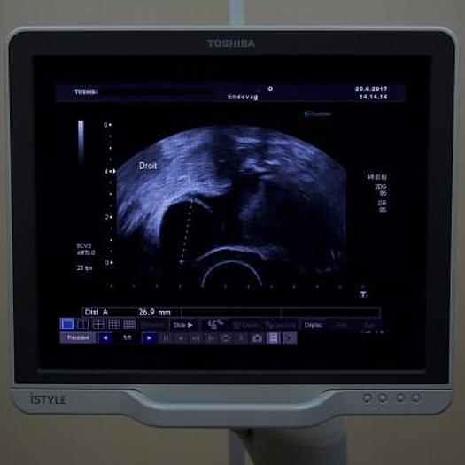 Used ECHOGRAPHE DOPPLER COULEUR TOSHIBA XARIO ISTYLE