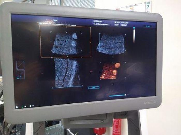 Used SAMSUNG MEDISON Accuvix A30 OB / GYN - Vascular Ultrasound