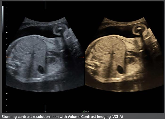 Used 2014 General Electric (GE) Voluson S8