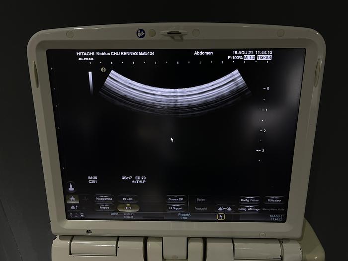 Gebraucht Hitachi/Aloka Noblus Ultraschallgerät auf Cart mit 2 Ultraschallsonden