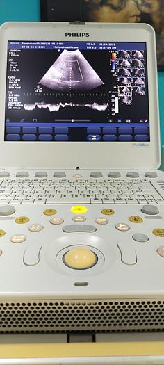 Gebraucht Philips CX50 tragbare Ultraschallgerät auf Philips CX Wagen inkl. Netzteil