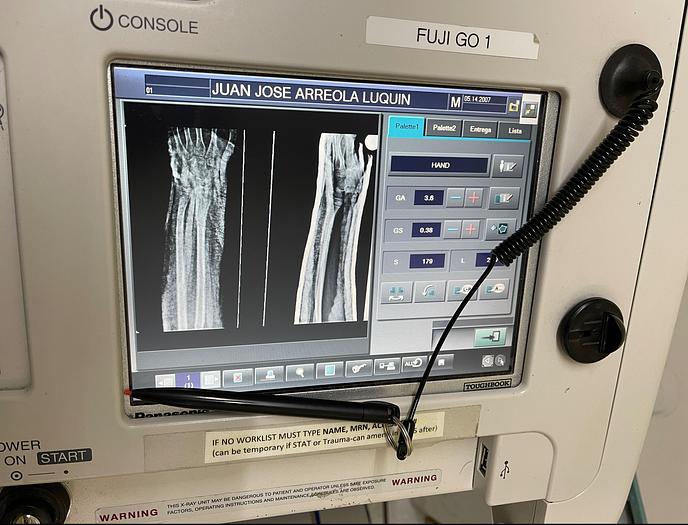 Used 2011 FujiFilm FCR GO-2