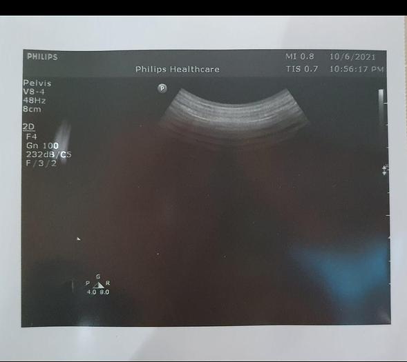 Gebraucht philips V8-4