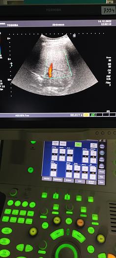 Gebraucht Toshiba PVT-375 Konvex Ultraschallsonde