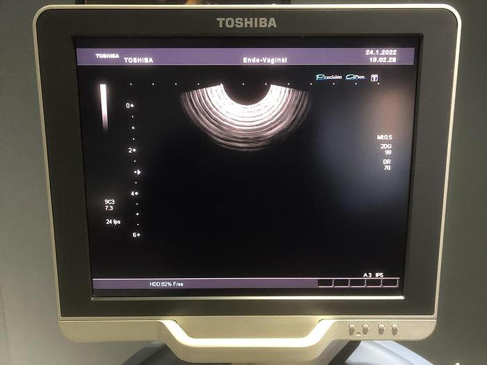 Gebraucht TOSHIPA-Xario-Ultraschallgerät-5046