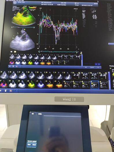 Gebraucht GE Vivid T8 Ultraschallsystem für Herz- und Gefäß-Ultraschall mit Kardio Sonde SW: R1.0.7