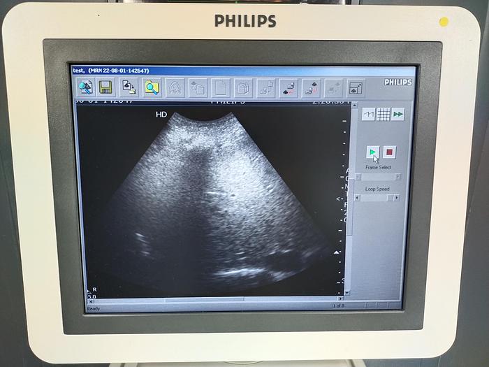 Gebraucht Philips HD7 diagnostik Ultraschallsystem mit DVD Brenner ohne Drucker SW 1.1