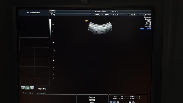 Gebraucht GE Voluson E8 Ultraschalgerät