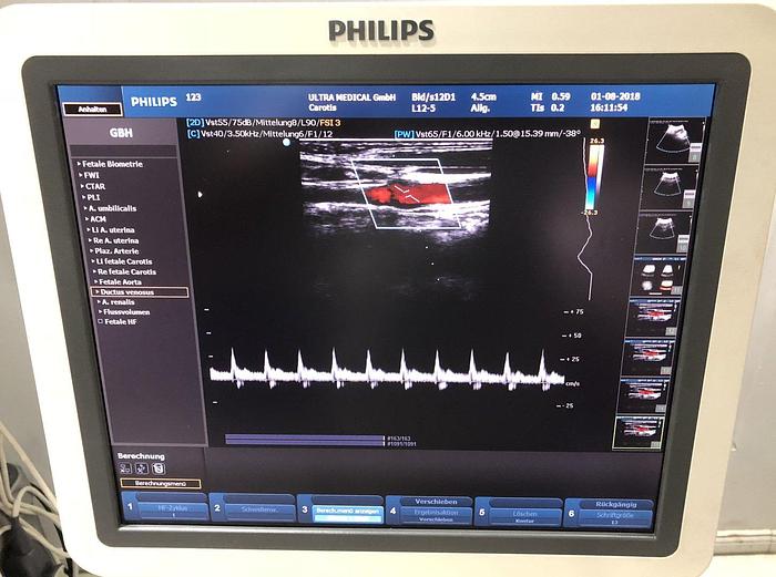 Used Philips HD9 Ultraschallgerät mit 3 Sonden 3D/4D-option