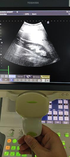 Gebraucht Toshiba PVT-375BT konvex Ultraschallsonde