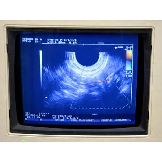 D'occasion ECHOGRAPHE HITACHI KATANA 5 COULEUR DOPPLER AVEC 3 SONDES