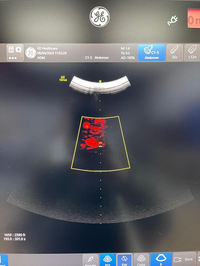 Used GE Venue YOM: 2018 With 3 Probes.
