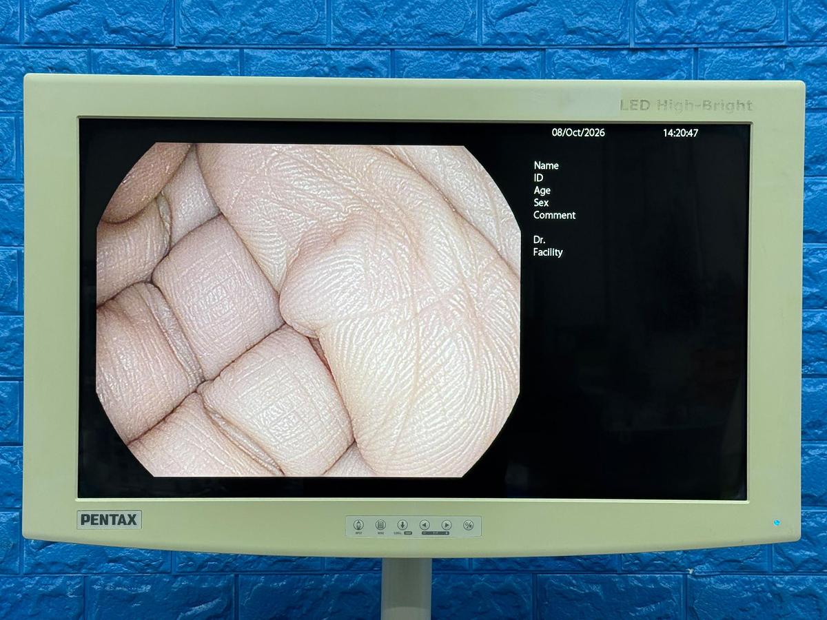 Used Pentax EPK-i7000 Complete Endoscopy Tower with Gastroscope & Colonoscope YOM 2013