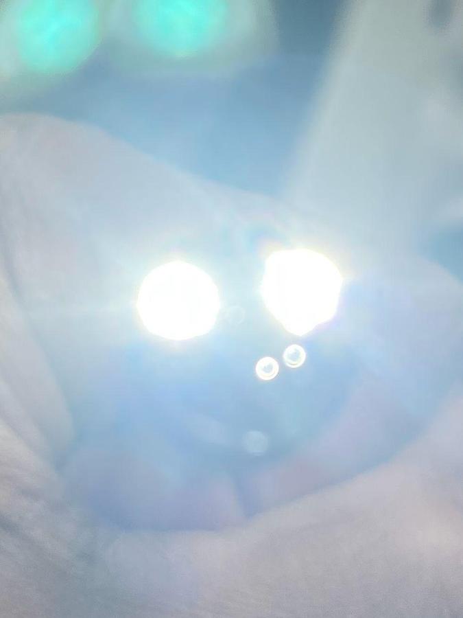 Used FUJINON Scope Model: EC-600WM Colonoscope Colonoscope