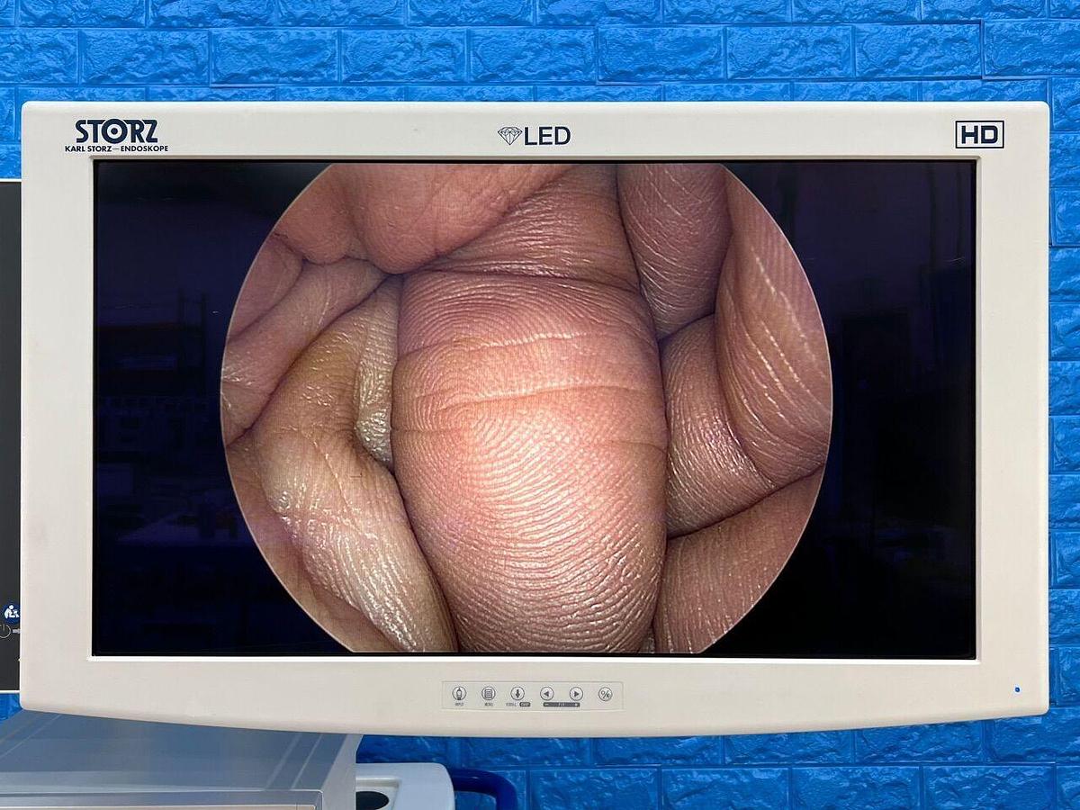 Used KARL STORZ S Spies TC200, TC300, TC301 and TH100 complete tower