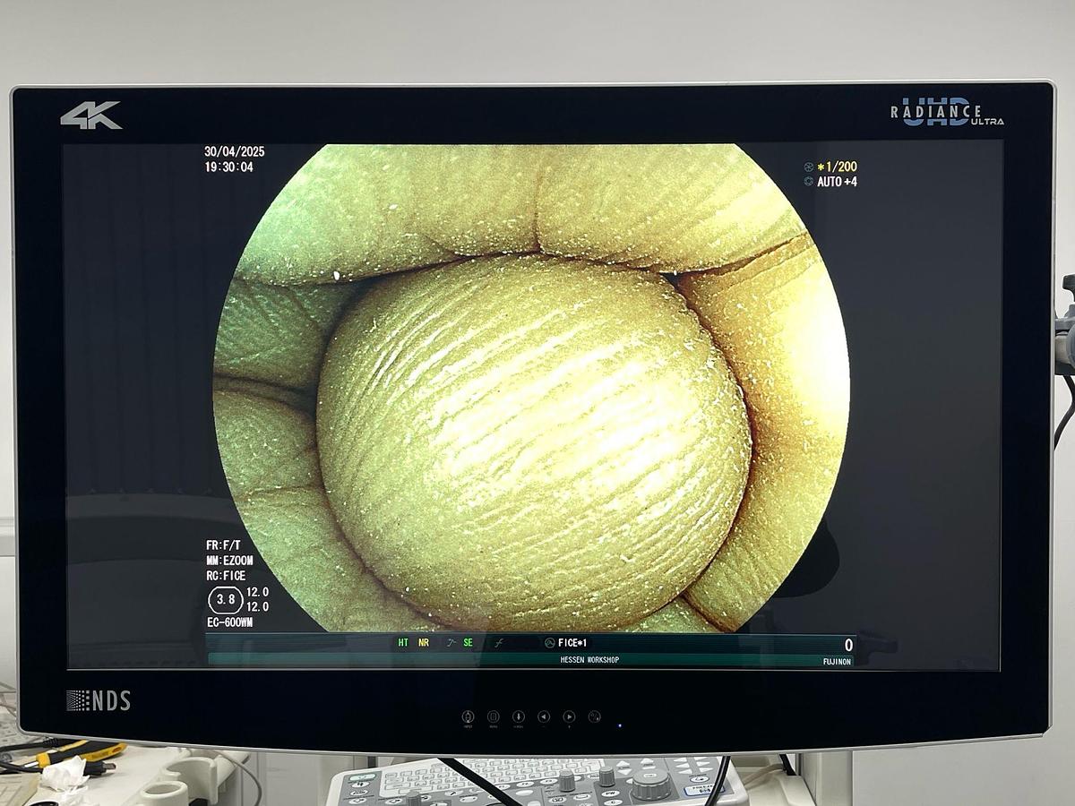 Used FUJINON Scope Model: EC-600WM Colonoscope Colonoscope