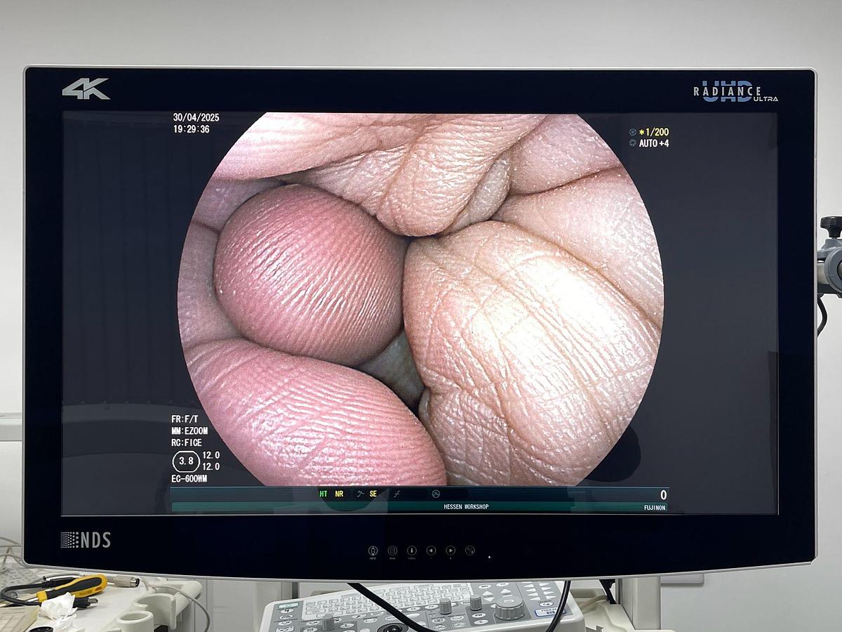 Used FUJINON Scope Model: EC-600WM Colonoscope Colonoscope