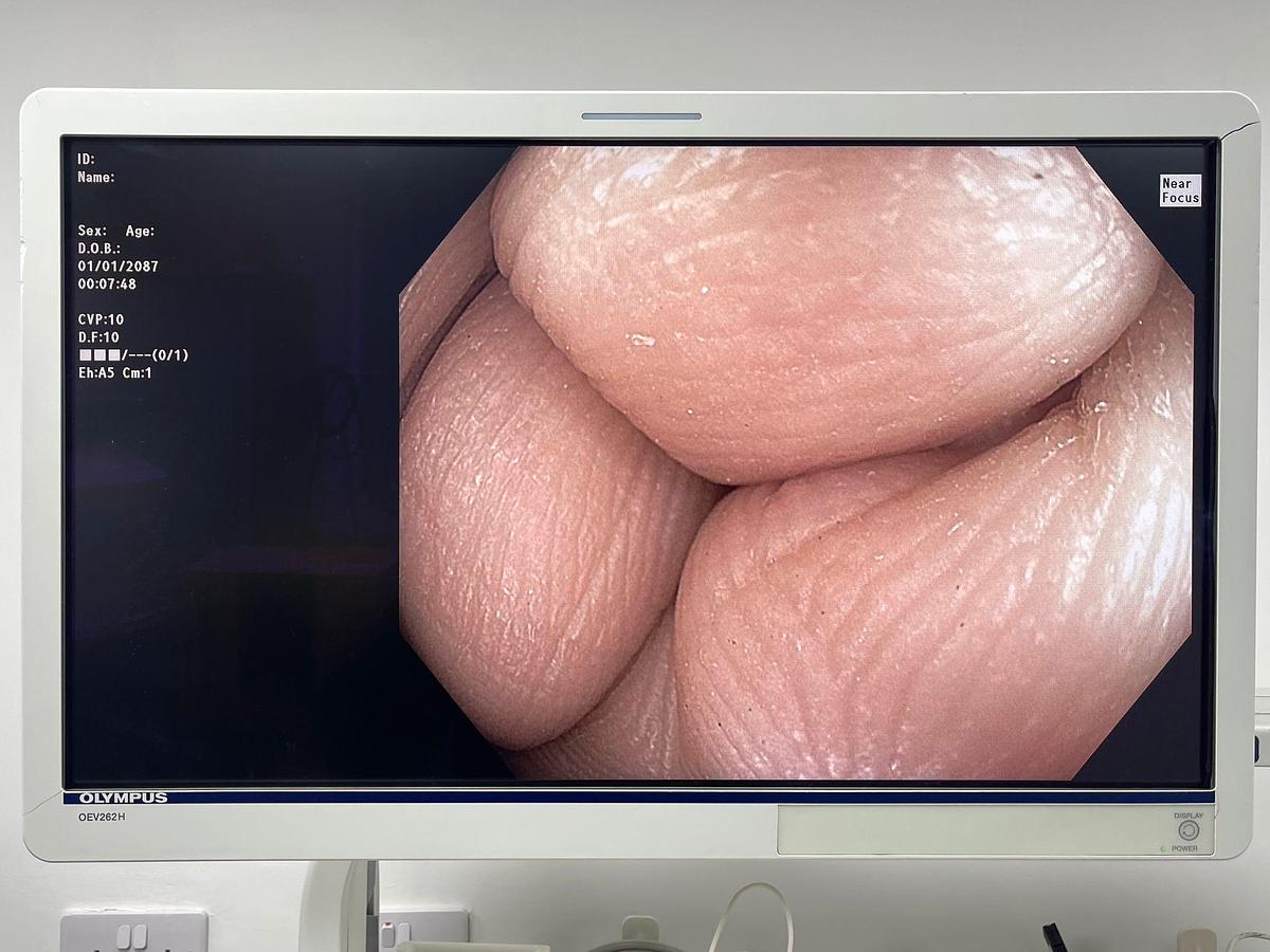 Used Olympus Scope Model: CF-HQ190L